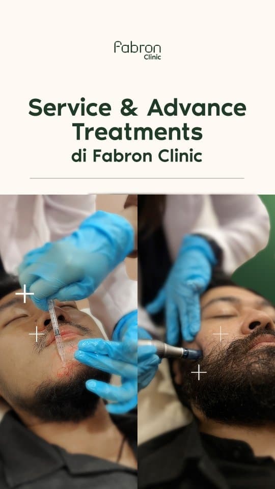 Beard Dermapen Serum Fabron Clinic