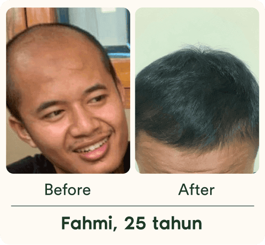 Testimoni pasien Fabron 5
